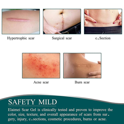 Dermoxy™ Scar Removal Tape